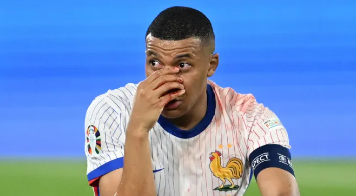 Mbappe phải dùng tay để cố định chiếc mũi bị gãy của mình. Chiếc áo thi đấu màu trắng của anh cũng bị ố bẩn với những vết máu loang khắp từ vai đến ngực.