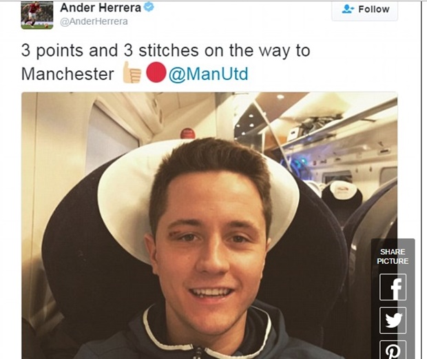 Ander Herrera đổ máu, phải khâu 3 mũi - Bóng Đá