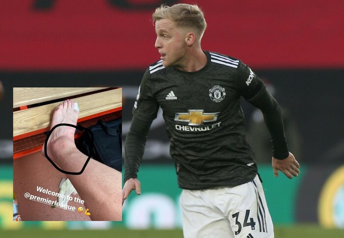 Van de Beek đã chiến đấu suốt cả trận với cái chân trái bị sưng to. Dù vậy, anh không hề kêu ca.