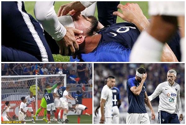 Ảnh bài viết Lãnh trọn cú đấm của thủ thành tuyển Mỹ, Oliver Giroud đổ máu, gục xuống sân