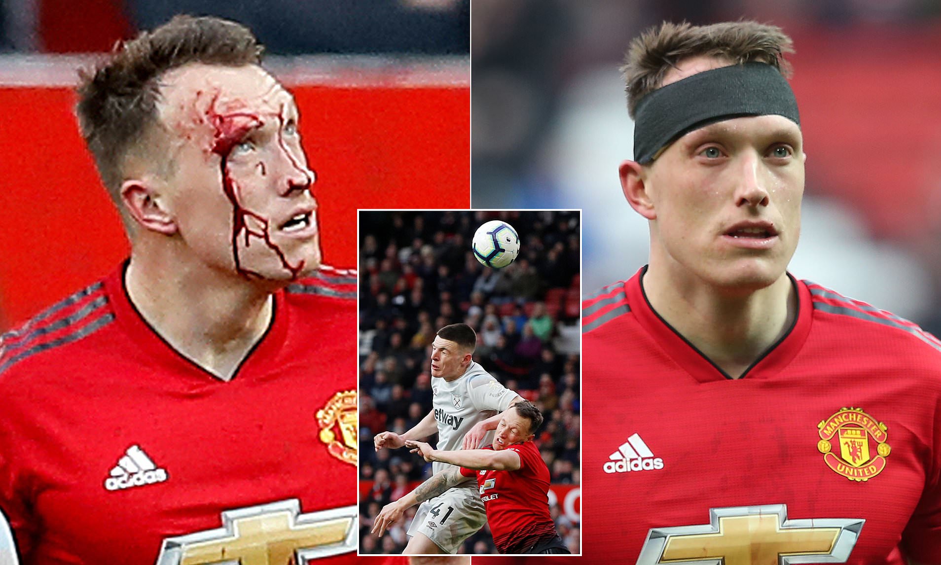 Ảnh bài viết Phil Jones 'đổ máu' là tấm gương cho các cầu thủ Man Utd thời điểm này