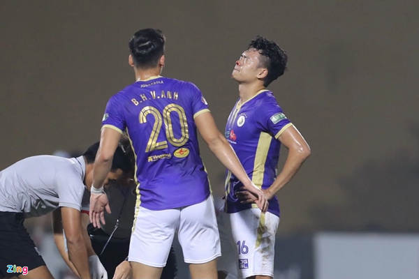Ảnh bài viết Thành Chung chảy máu mũi