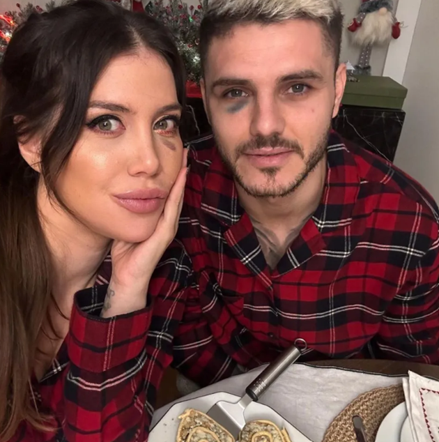 Hậu quả như đã thấy, mắt phải của Icardi lãnh một vết bầm và Wanda Nara, vợ của cầu thủ này đã "tung hứng" bằng cách phết lên gò má mình một màu đen tương tự.