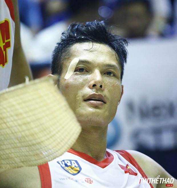 “Độc cô cầu bại” Nguyễn Văn Hùng choàng tỉnh sau khi được các nhân viên y tế chăm sóc. Mí mắt phải của cựu tuyển thủ taewondo Việt Nam bị bầm tím và được băng lại. Khuôn mặt của Văn Hùng gần tái lại và cảm giác choáng voáng sau khi tông mạnh. Ảnh: TinTheThao.com.vn.