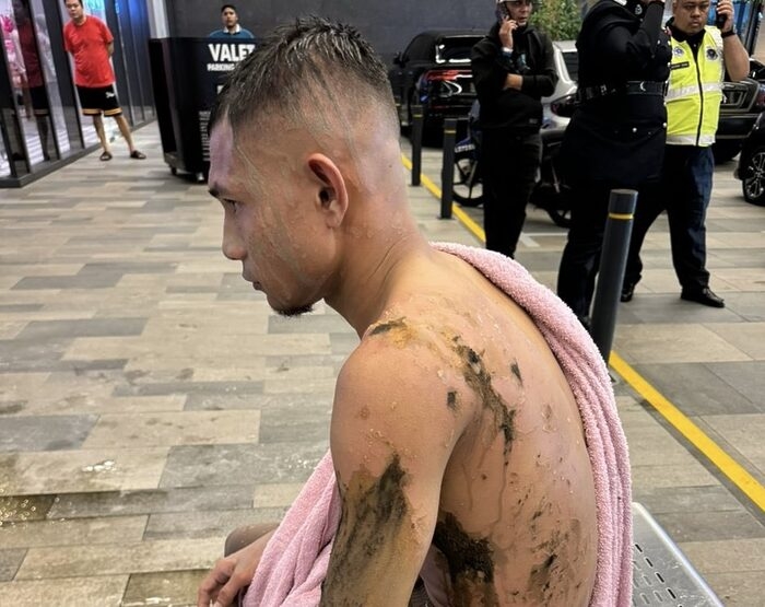 Ảnh bài viết Cầu thủ Malaysia bị tạt axit, HLV Guinea nhận xét về U23 Indonesia