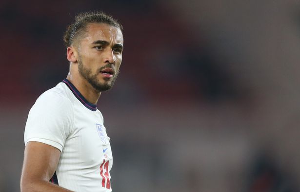 Dominic Calvert-Lewin hiện đang dính chấn thương.