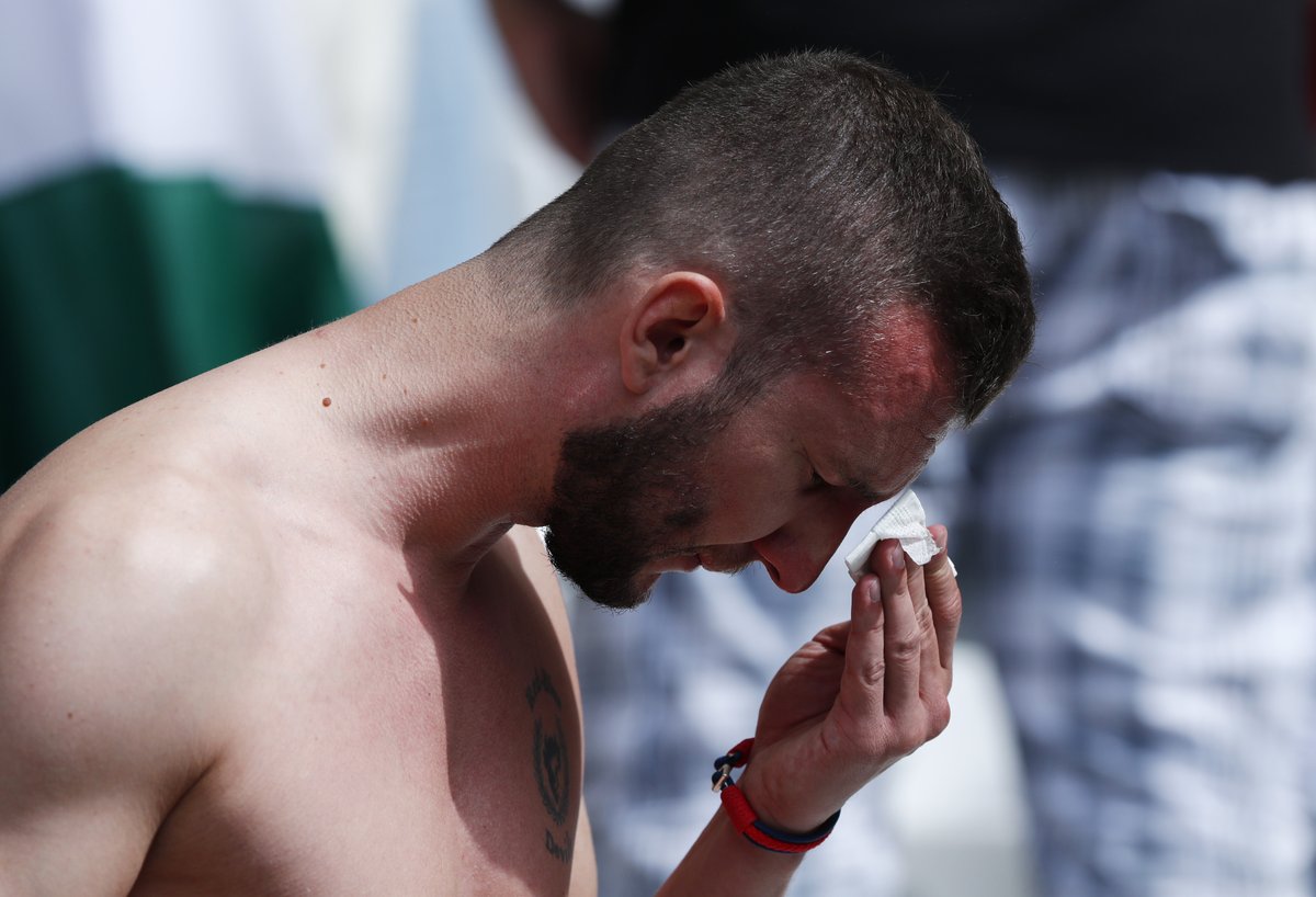 Một CĐV đổ máu sau xô xát. Ảnh: Internet