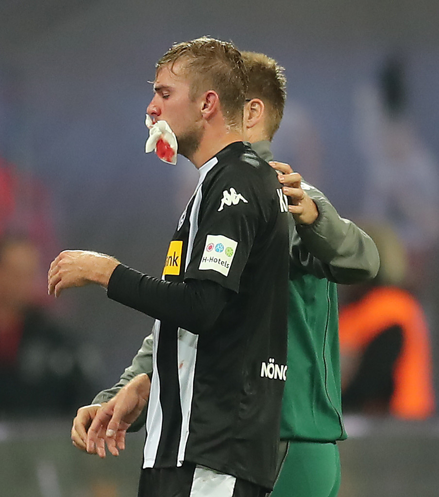 Christoph Kramer đổ máu sau pha va chạm với Naby Keita.