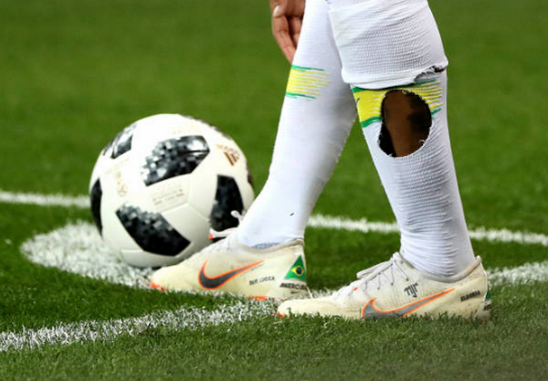 Thậm chí, vớ của Neymar đã bị thủng một lỗ rất lớn sau tình huống phạm lỗi của cầu thủ đối phương.