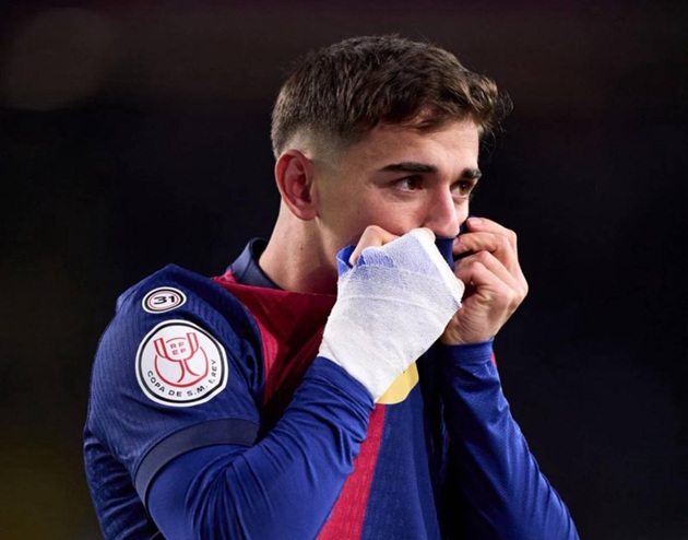 Gavi vẫn đang bị ảnh hưởng bởi những cơn đau.