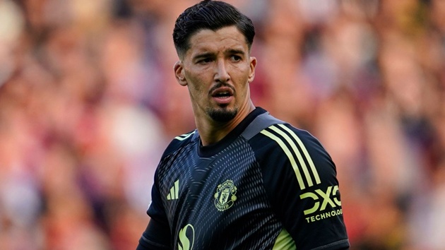 Bayindir sẽ bắt chính tại derby Manchester